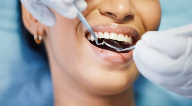 Best Walk-In Emergency Dentist in The Villages, FL